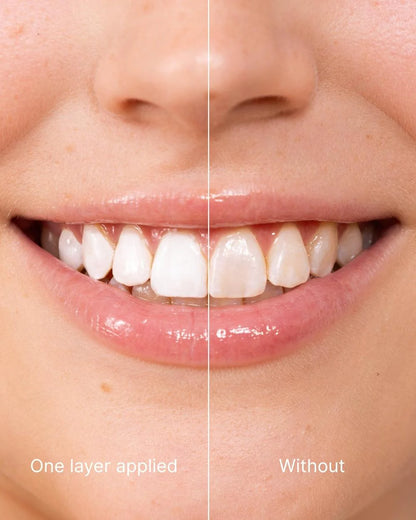 Teeth Polish - Instant White Teeth